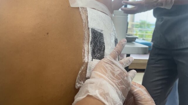 healer is applying a poultice to a lump on the back of a male patient.