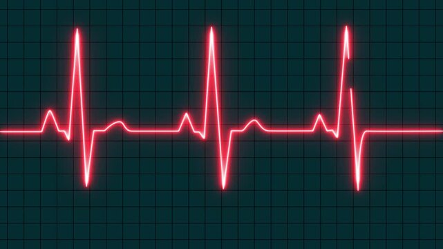 Sky Blue color EKG heart line monitor. Emergency EKG monitoring. pulse line. ECG heartbeat monitor. Motion graphics of Electrocardiogram Medical