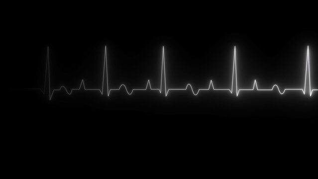 White heartbeat line showing an ekg pulse signal on a black background