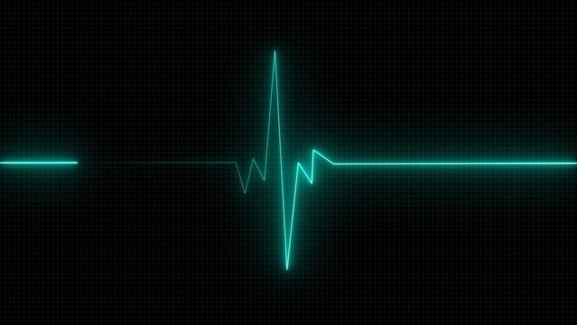 Neon green heartbeat line showing a medical pulse rhythm isolated on a dark background