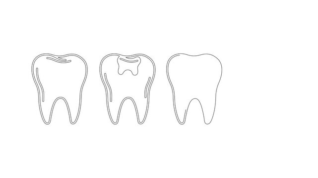 Animation of four teeth health status icons developing on white background.