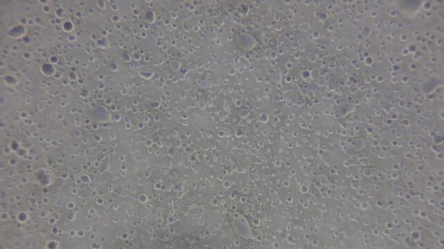 ​Whipped Cream Under Microscope Showing Fat Globules and Air Bubbles