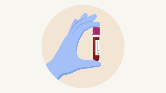 Gloved hand holding a blood sample tube for medical testing and diagnosis