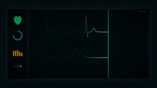 Medical Monitor Heartbeat Scene With Silent ECG Display.