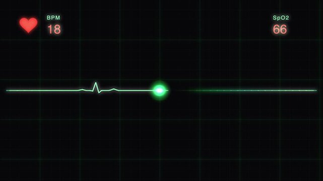 Medical heart rate monitor ekg display with increasing bpm and sp o2 levels