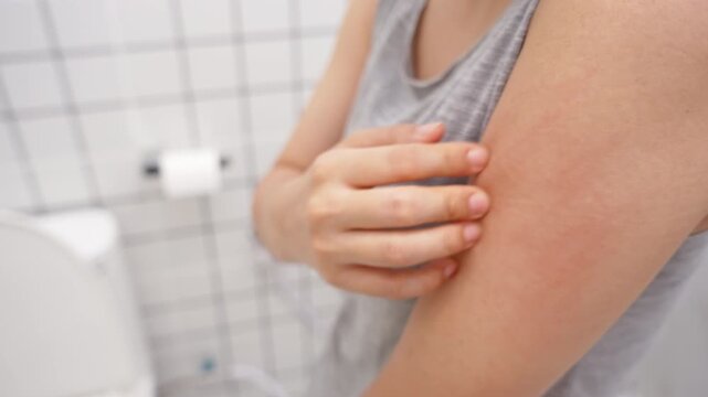 skin problem and beauty. Young woman scratch body has itchy skin from skin allergic, steroid allergy, sensitive skin, red from sunburn, chemical allergy, rash, insect bites, Seborrheic Dermatitis.