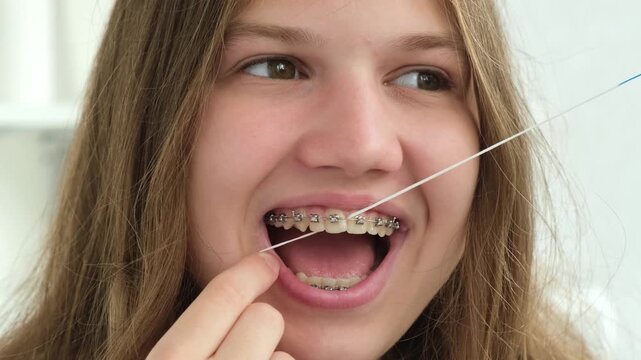 Teen girl with braces cleaning teeth using dental floss. Dental hygiene during orthodontic treatment
