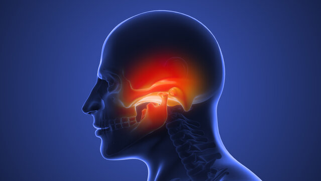 Facial Pain Caused by TMJ Dysfunction
