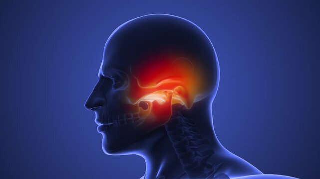 Facial Pain Caused by TMJ Dysfunction