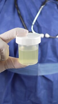 Gloved fingers hold a clear urine specimen cup in front of a blue uniform with stethoscope. Clean vertical framing for lab testing, diagnostics, or healthcare education concepts.