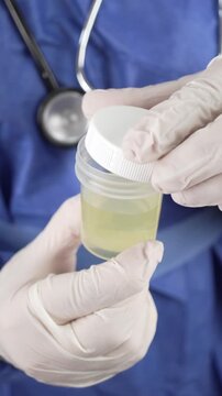 Urine specimen container filled with pale yellow fluid is sealed by a gloved hand in front of blue scrubs and a stethoscope, shot in vertical format for clinical testing themes.