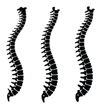 Tres siluetas negras de columnas vertebrales humanas