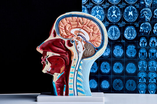 Brain cross section anatomical model beside magnetic resonance imaging scans used for neurological examination, clinical diagnosis and healthcare education