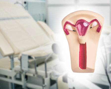 Uterus anatomical model on background of gynecological chair in clinic. Gynecology diagnostics and female reproductive health exam.