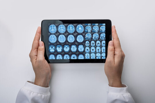 Professional scientist reviewing digital magnetic resonance imaging of patient head on tablet screen. Neurology exam.