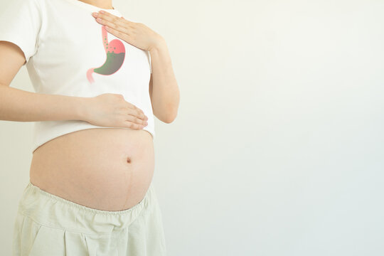 Indigestion and heartburn in pregnancy. Pregnant woman suffering from acid reflux, nausea and bloating due to hormonal changes. Health problems in pregnancy