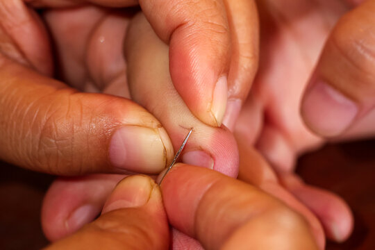 Close up of hands removing splinter with needle, focused on careful gentle care and minor first aid in home setting