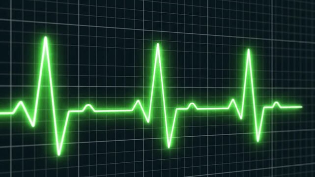Green electrocardiogram pulse line moving across a dark grid background for healthcare concepts