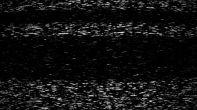 4K Old tv static glitch overlay animation featuring heavy monochrome noise, grains, analog signal distortion and crt noise texture. Perfect cinematic film project.