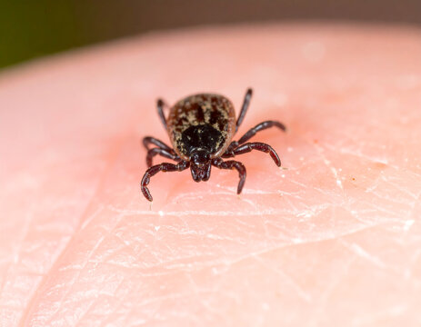 Tick crawling on human skin. Deer tick.