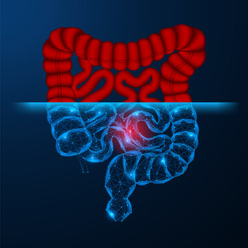 Digital scanning of the digestive system. The concept of early detection of diseases, high-precision diagnostics of the intestine and innovative healthcare technologies.
