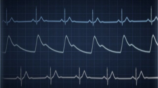 ECG heartbeat waveform sweeping across a medical monitor grid seamless loop in rich blue tones