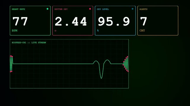 Advanced medical anomaly detection displayed on three green monitor screens showing vital signs and heart rate data in a dark laboratory setting