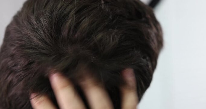 Man scratching his head with dandruff at home, closeup. Camera moving forward and backwards