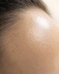 Naklejka premium Extreme Close Up of Oily Forehead With Excess Sebum and Visible Pores