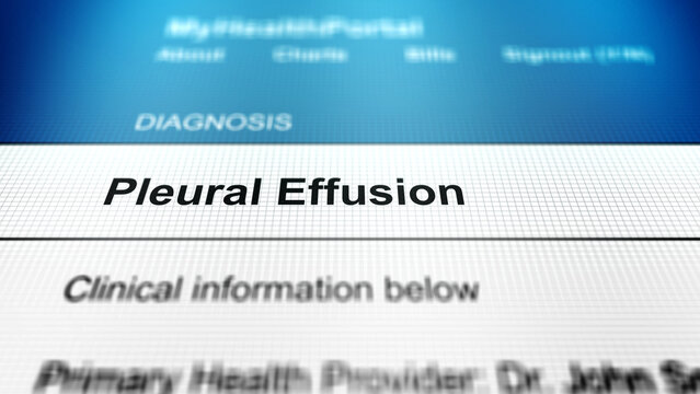  Generic Health Portal with Cough Sickness - Pleural Effusion