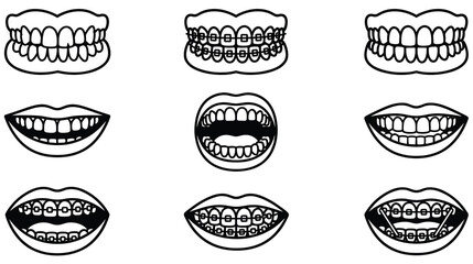 Set of dental care concepts showing different types of teeth and braces. © SADIKUR