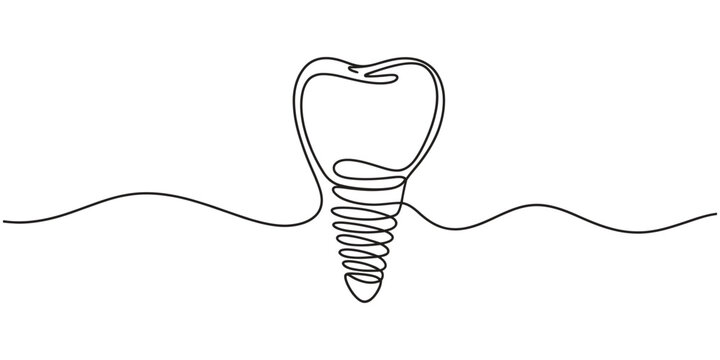 Continuous single line drawing of a dental implant tooth