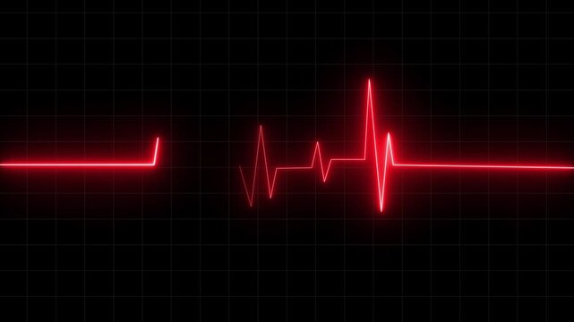 Heartbeat Monitor Animated Video, Heartbeat Medical Cardiogram Animation