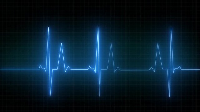 Lootable Blue EKG/ECG cardiogram oscilloscope monitor heartbeat line chart shows 60 BPM heart rate on black background with grid 4k video animation