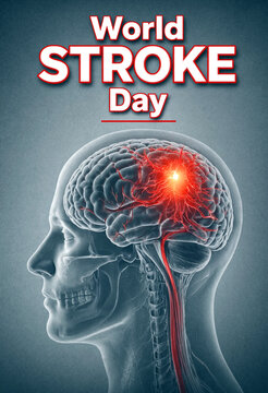 Medical illustration showing human brain affected by stroke with highlighted blood vessels and nerves