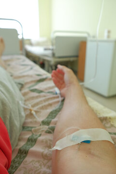 Patient resting in a hospital bed with a peripheral intravenous catheter in the arm during infusion therapy. Close-up of IV access, medical treatment, healthcare and patient recovery