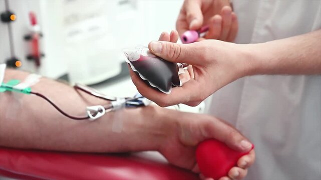 Footage of a donor hand squeezing a red heart shaped ball while blood is drawn, through the tube from the arm during a blood donation at a clinic.