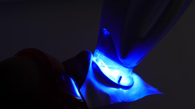close-up of a dental whitening procedure. Bright blue curing light illuminating the open mouth with a blue retractor against a dark background. Professional stomatology treatment 4k video