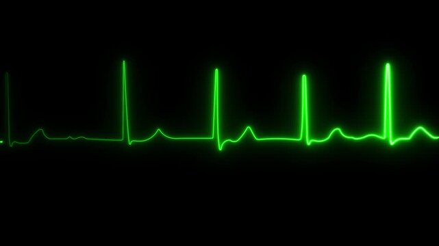 Green ekg heartbeat monitor loop: medical cardiology pulse line animation for healthcare and emergency technology presentations