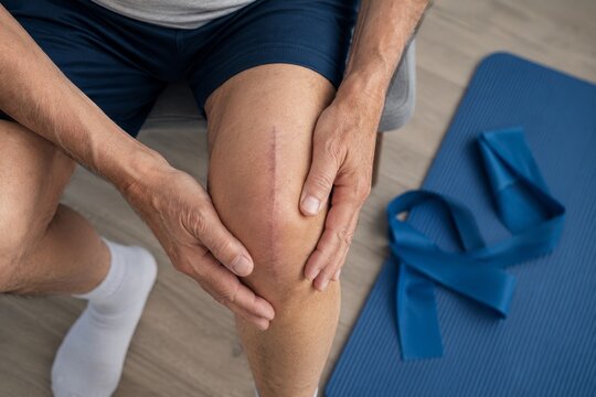 Senior man touching knee with surgical scar after joint replacement surgery. Patient doing physical therapy with resistance band for rehabilitation of knee injury. Orthopedic medical recovery.