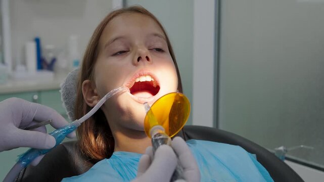 Pediatric dentist using UV curing light lamp on tooth filling for young girl.