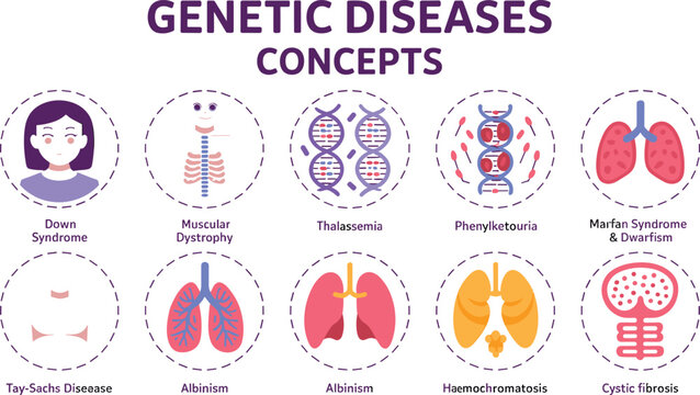 Genetic Diseases Concepts Flat Vector Icon Set Featuring Circular Icons for Down Syndrome Thalassemia Phenylketonuria Albinism and Cystic Fibrosis Medical Infographics