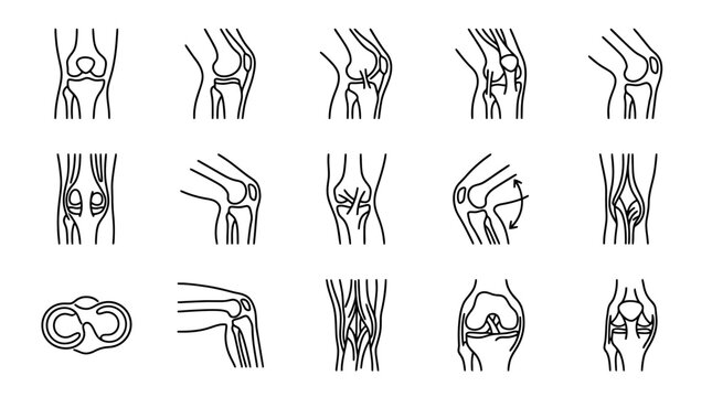 Knee Joint Anatomy Illustrations: Multiple Views and Conditions