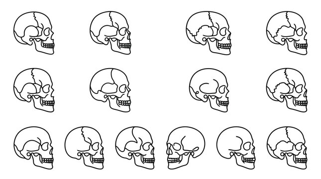 Human Skull Anatomy Outline, Side View, Multiple Angles