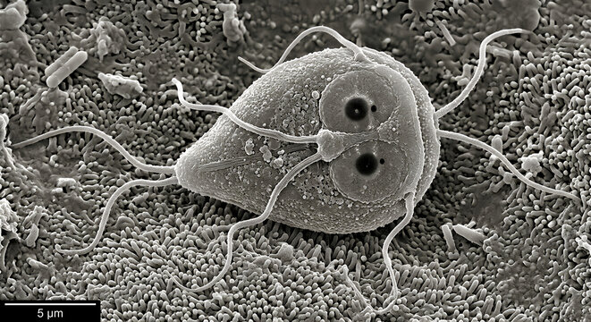 A high-resolution medical microscope photograph of a Giardia lamblia trophozoite. 