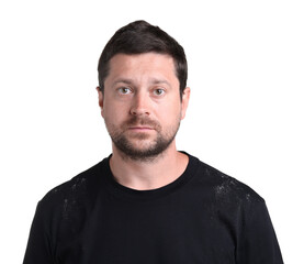 Fototapeta premium Unhappy man with dandruff on his t-shirt against white background