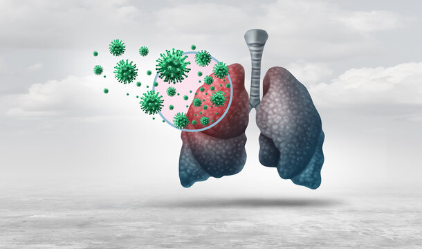 Pneumonia outbreak concept showing a contagious respiratory infection spreading through the lungs with severe coughing, breathing difficulties, and growing public health concerns over infectious