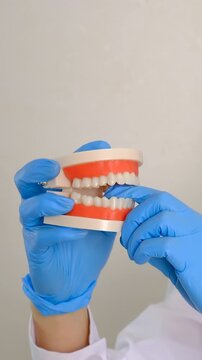 A dentist shows a model of a jaw. Selective focus.