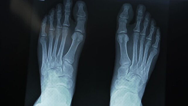Healthcare professional positions a foot X-ray on a diagnostic light board for clinical review. Medical imaging, trauma assessment, orthopedic examination, podiatry, and patient care concept.