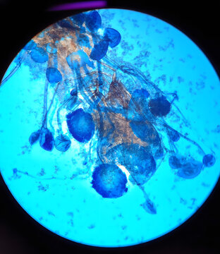 Microscopic View of Fungal Spores Under Laboratory Microscope